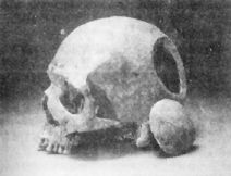 英格兰4000年历史的颅骨