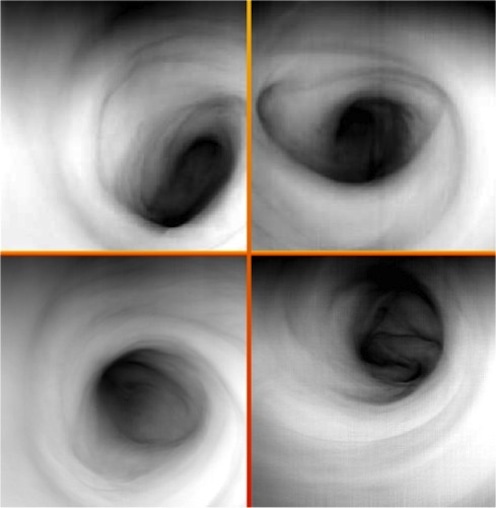 这是一组拍摄于红外波段（波长3.8微米）的金星南极上空气旋的图像，由欧洲空间局正在金星轨道运行的“金星快车”探测器搭载的可见光和红外热成像光谱仪获取。图像上反映的是金星上空大约65公里的高度上的云层顶温度分布情况。暗色区域指代温度较高。也就是高度较低的区域。可以看到在气旋的中心，温度约为250K（约合23摄氏度）的温度区间上是这个气旋中海拔高度最低的区域，显示了最高的温度数值